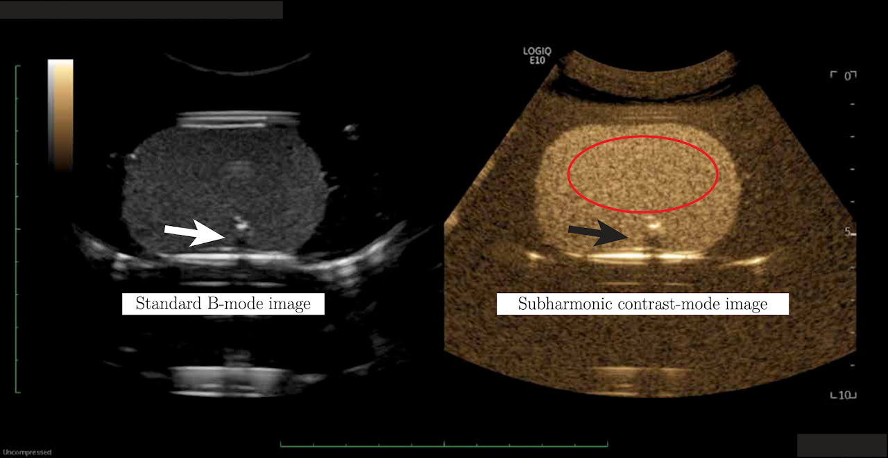 Ultrasound image of microbubbles inside the bladder phantom