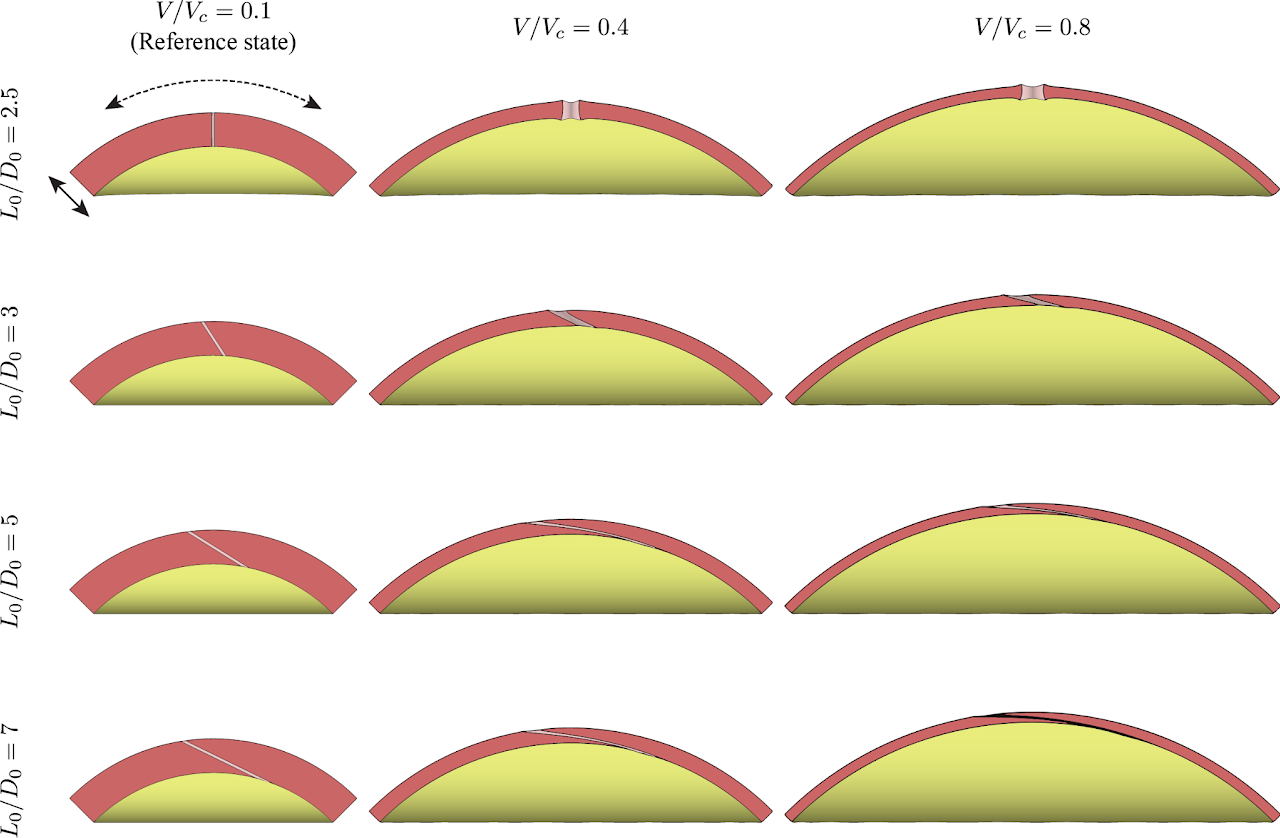 How the UVJ insertion angle controls its closure during urine storage